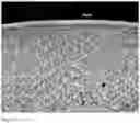 Fig. 02 - Method of case hardening a group IV metal