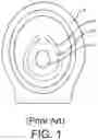 Fig. 02 - Graduated oval plunger system