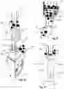 Fig. 08 - Rain gutter dredger and use thereof