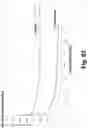 Fig. 72 - New Apparatus and Methods for Disease Detection