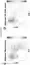 Fig. 09 - A METHOD FOR DETERMINING MYELOID NATURAL KILLER (NK)-CELLS AND USE THEREOF