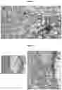 Fig. 40 - A METHOD FOR DETERMINING MYELOID NATURAL KILLER (NK)-CELLS AND USE THEREOF