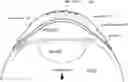 Fig. 01 - Non-circular contact lenses with payloads