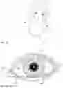 Fig. 02 - Non-circular contact lenses with payloads