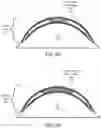 Fig. 06 - Dynamic presbyopia correction in electronic contact lenses