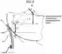 Fig. 04 - Cleaning device for removing a developer, process cartridge and image forming apparatus