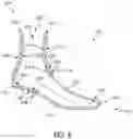 Fig. 07 - Sock with zones of varying layers