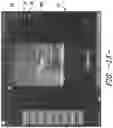 Fig. 09 - Methods for Needle Identification on an Ultrasound Display Screen