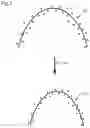 Fig. 04 - Device for analyzing occlusion pressure, program for analyzing occlusion pressure, and method for analyzing occlusion pressure