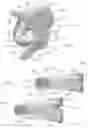 Fig. 02 - Expandable intervertebral implant
