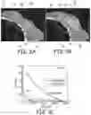 Fig. 06 - Echolucent implant composition and methods