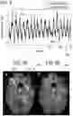 Fig. 05 - Data driven correction of phase depending artefacts in a magnetic resonance imaging system