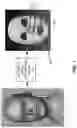 Fig. 02 - Method and system for creating a cut mask from a 3D surface mesh