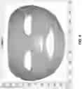 Fig. 05 - Method and system for creating a cut mask from a 3D surface mesh