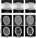 Fig. 01 - METHOD AND SYSTEMS FOR ANALYZING MEDICAL IMAGE DATA USING MACHINE LEARNING
