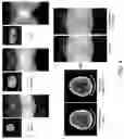 Fig. 05 - METHOD AND SYSTEMS FOR ANALYZING MEDICAL IMAGE DATA USING MACHINE LEARNING