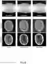 Fig. 07 - METHOD AND SYSTEMS FOR ANALYZING MEDICAL IMAGE DATA USING MACHINE LEARNING