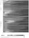 Fig. 07 - TRANSCRIPTOME DECONVOLUTION OF METASTATIC TISSUE SAMPLES