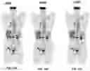 Fig. 14 - Systems and methods for image reconstruction