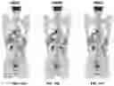 Fig. 15 - Systems and methods for image reconstruction