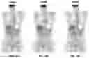 Fig. 16 - Systems and methods for image reconstruction