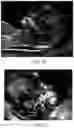 Fig. 09 - Method of obtaining medical sagittal image, method of training neural network and computing device
