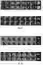Fig. 08 - SYSTEMS AND METHODS FOR DIAGNOSING TUMORS IN A SUBJECT BY PERFORMING A QUANTITATIVE ANALYSIS OF TEXTURE-BASED FEATURES OF A TUMOR OBJECT IN A RADIOLOGICAL IMAGE