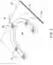 Fig. 03 - Correcting medical scans