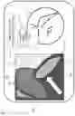 Fig. 10 - Correcting medical scans