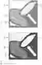 Fig. 12 - Correcting medical scans
