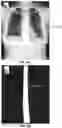 Fig. 11 - Systems and methods for generating image metric