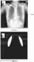 Fig. 12 - Systems and methods for generating image metric