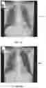 Fig. 14 - Systems and methods for generating image metric