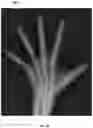 Fig. 07 - Systems and methods for ossification center detection and bone age assessment