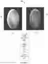 Fig. 05 - METHOD AND SYSTEM FOR DETECTING DISORDERS IN RETINAL IMAGES
