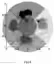Fig. 08 - Toothbrush coaching system