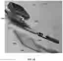 Fig. 17 - Replacement heel pedestal device and system