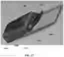 Fig. 18 - Replacement heel pedestal device and system