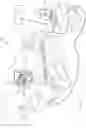 Fig. 02 - DISEASE GUIDED INSERTION FOR IMPLANTS