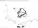 Fig. 06 - METHOD AND SYSTEM TO CHARACTERIZE DISEASE USING PARAMETRIC FEATURES OF A VOLUMETRIC OBJECT AND MACHINE LEARNING
