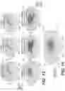 Fig. 17 - METHOD AND SYSTEM TO CHARACTERIZE DISEASE USING PARAMETRIC FEATURES OF A VOLUMETRIC OBJECT AND MACHINE LEARNING