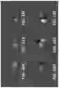 Fig. 19 - METHOD AND SYSTEM TO CHARACTERIZE DISEASE USING PARAMETRIC FEATURES OF A VOLUMETRIC OBJECT AND MACHINE LEARNING
