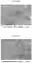 Fig. 20 - Three-dimensional photodetector and method of manufacturing the same