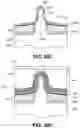Fig. 53 - Gate cut and fin trim isolation for advanced integrated circuit structure fabrication