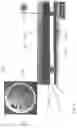 Fig. 06 - Button cell having winding electrode and method for the production thereof