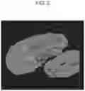 Fig. 03 - ELECTRODE ACTIVE SUBSTANCE, METHOD FOR PRODUCING ELECTRODE ACTIVE SUBSTANCE, AND ALL-SOLID BATTERY USING ELECTRODE ACTIVE SUBSTANCE