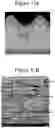 Fig. 11 - Secondary battery