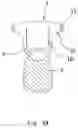 Fig. 11 - WEARABLE ANTENNA DEVICE