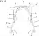 Fig. 09 - Wire crimping structure and shielded conductive path