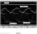 Fig. 05 - Systems and methods for operation efficiency in wireless power transfer